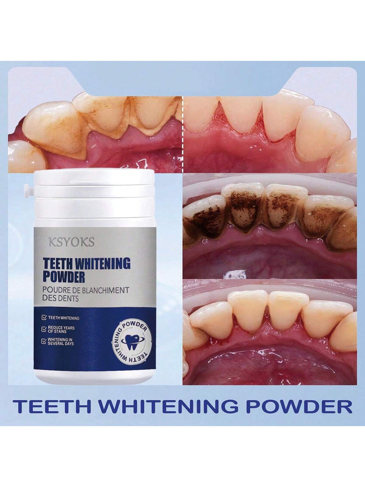 Teeth Whitening Kit Formula
