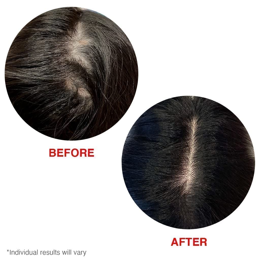 HAIRtamin Scalp Serum Natural Hair Growth Thickening Treatment | Made in USA | Helps Increase Hair Thickness and Aids Against Hair Thinning and Hair Fall Out | Moisturizes and Soothes Dry Itchy Scalp