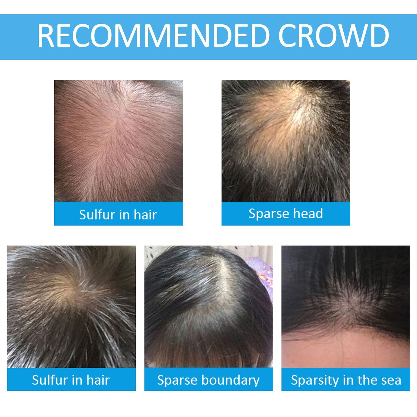 Hair Building Fibers for Thinning Hair with Spray Applicator Pump Nozzle - Natural & Undetectable,Instantly Thicker Fuller Hair Conceals Hair Loss 30 Sec,4 Shades for Men & Women,27.5g (Light Brown)
