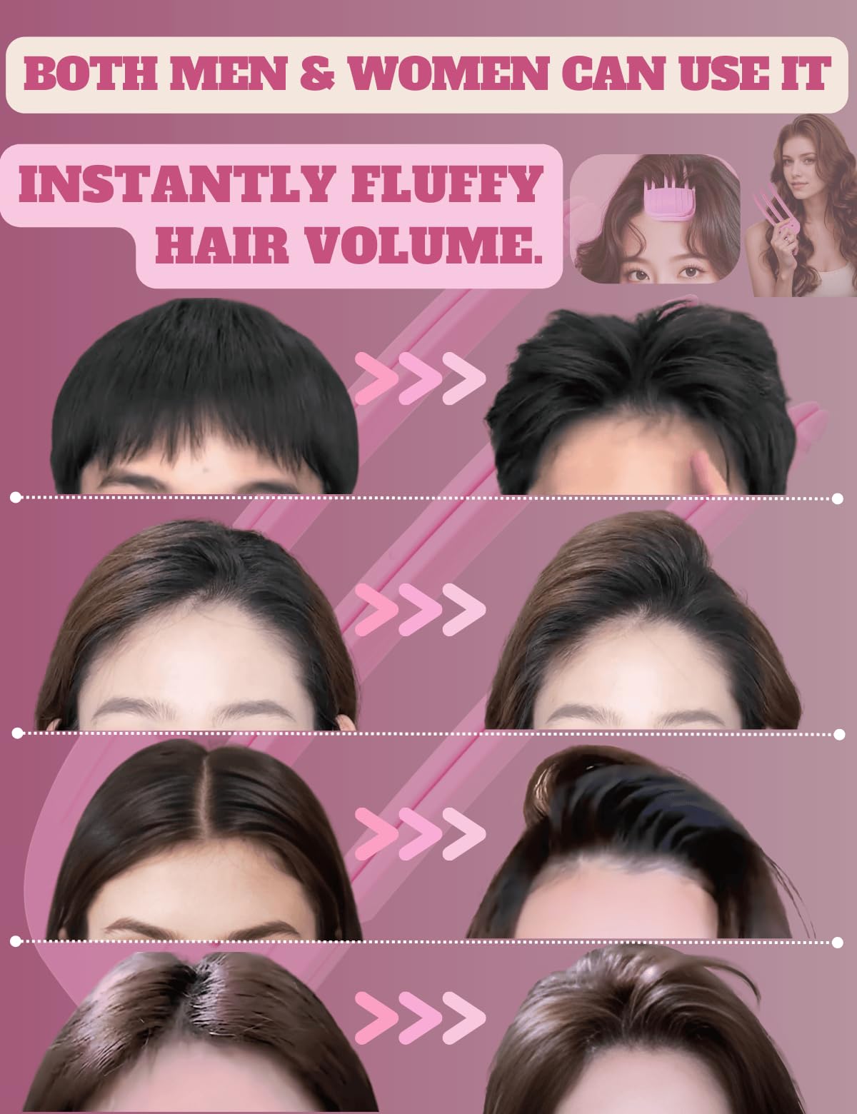 Hair Volume Clip, Volumizing Hair Clips - 2PCS Wind Shaping Styling Comb Set, Bangs Hair Clip for Creating Fluffy Bangs & Lifting Roots, Hair Volume Comb for Women & Men (FlaSloth)