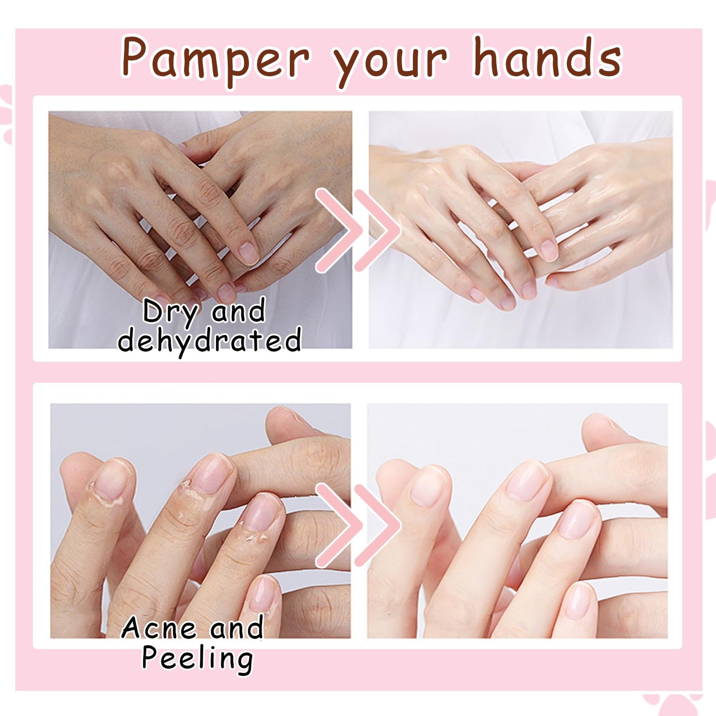 DWDiWen Hand Masks, 6 Pairs Hydrating Exfoliating Hand Peeling Mask, Smooth Hand Masks Moisturizing Gloves Overnight for Dry, Rough, Cracked Hands, Hand Skin Moisturizer Glove for Women Men(N