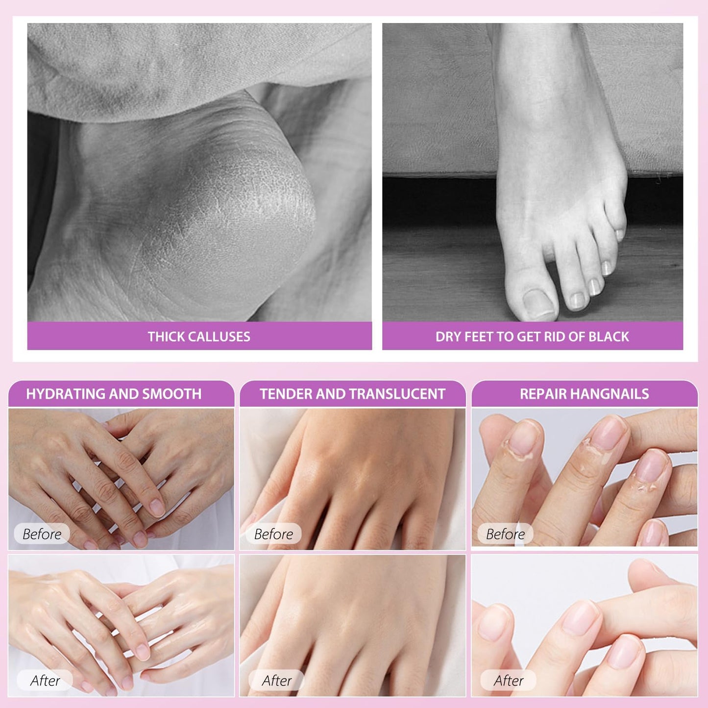 GUOYAOLIFU Hydrating Hand Foot Masks Set,Moisturizing Hand Mask for Dry Hand,Exofliating Foot Mask for Peeling Away Dead Skin Calluses,3 Pack Glove Mask&3 Pack Socks Mask for Women(Lavender)