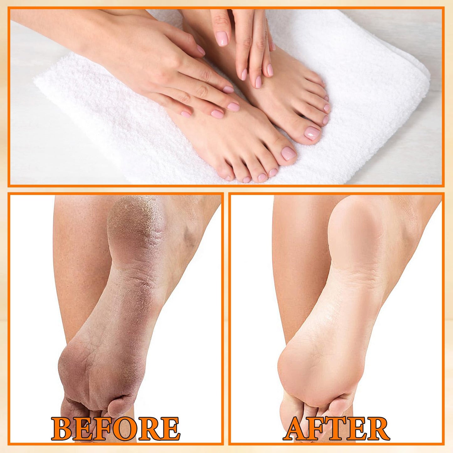 6PCS Foot Peel Mask,Exfoliating Foot Mask for Remove Dead Skin,Hydrating Foot Care Mask,Peel Off Mask for Calluses & Dry Toe Cracked Rough,Quickly Moisturizing & Nourishing Feet