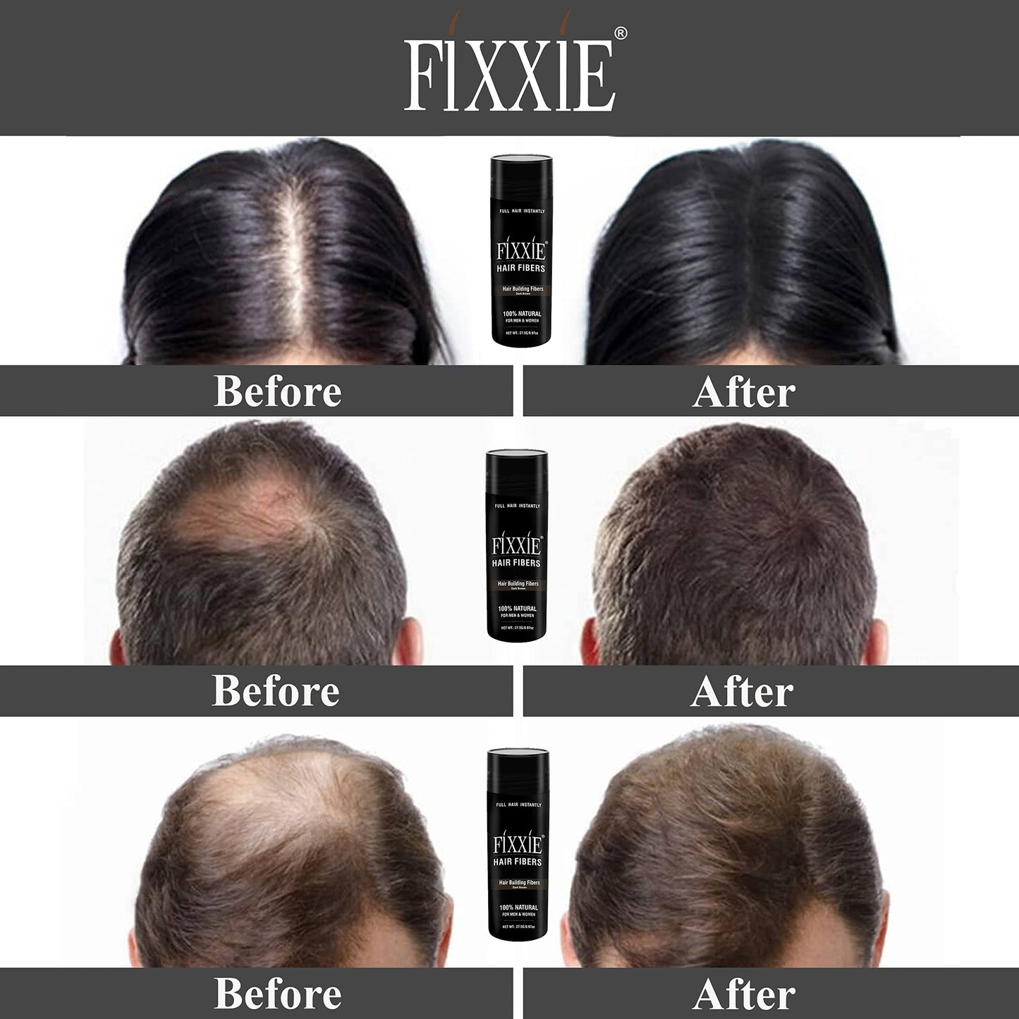 FIXXIE Hair Fibers Dark Blonde for Thinning Hair 27.5g Bottle, Concealer for Hair Loss, Men and Women, Naturally Thicker Looking With Keratin Fibres