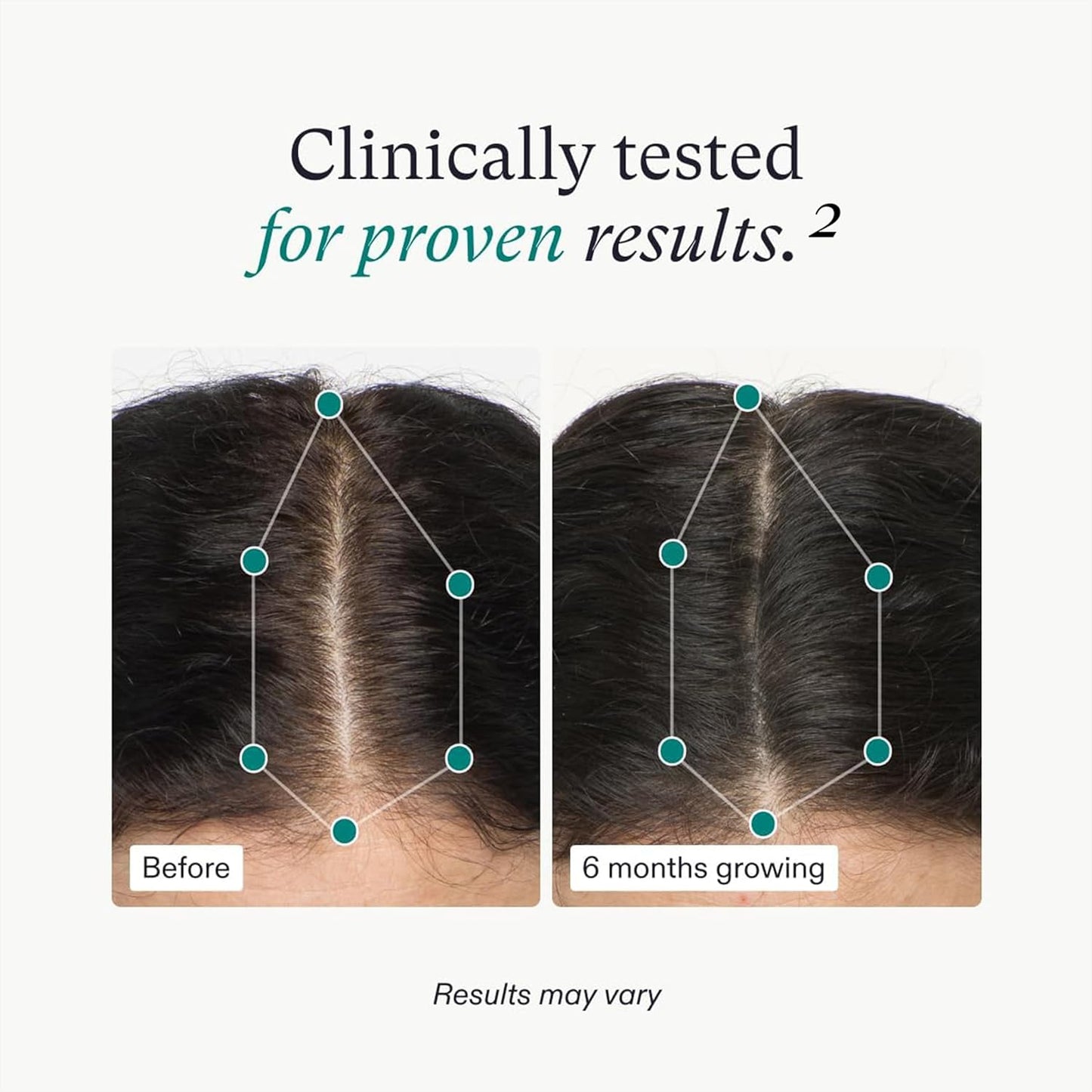 Nutrafol Women's Hair Growth