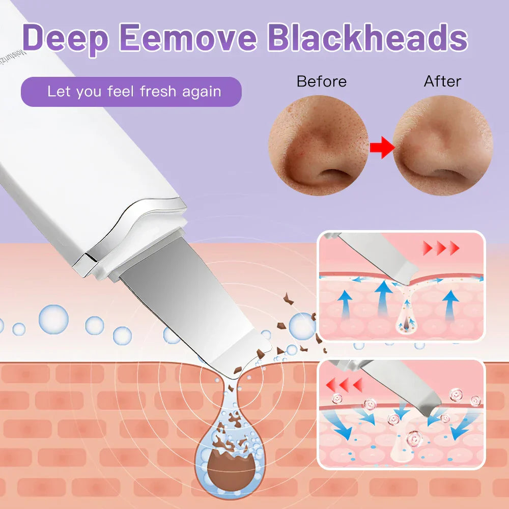 Ultrasonic Facial Skin Scrubber Tool