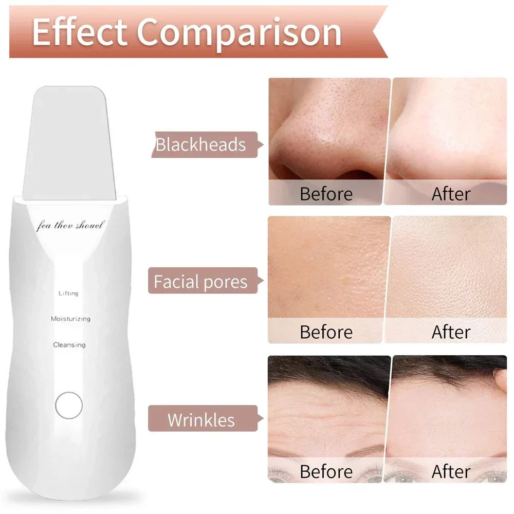 Ultrasonic Facial Skin Scrubber Cleanser