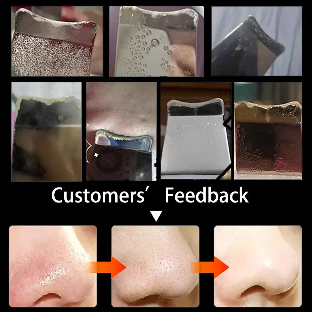 Ultrasonic Facial Skin Scrubber Cleanser