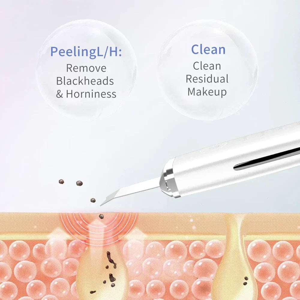 Ultrasonic Facial Skin Scrubber Cleanser