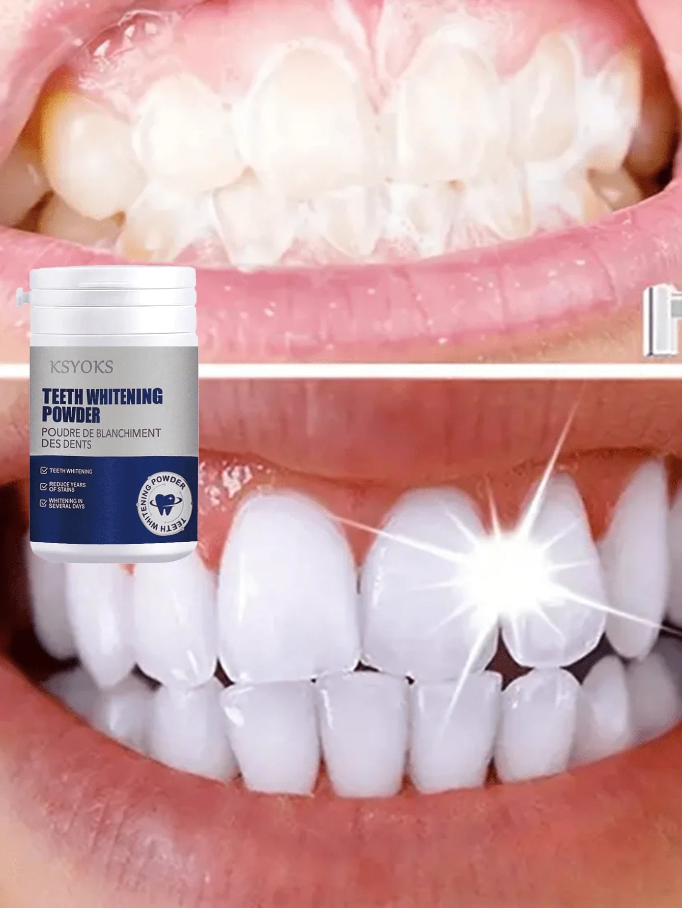 Teeth Whitening Kit Formula