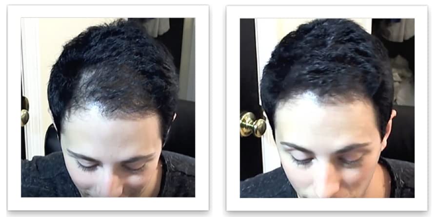 Caboki 10X Hair Powder for Thinning Hair. Instantly Fill In Hairline, Root Touch Up, Cover Bald Spots and Gray Hair. TALC-Free, Healthful Formula. Unisex. Trial Size, Salt and Pepper Dark