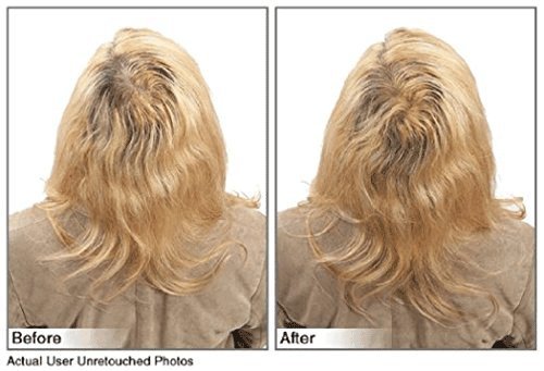Hair Building Fibers Instantly Conceal Thinning Hair and Bald Spots for Men & Women (Large 28 Grams Bottle) - Undetectable, Washes Away, For All Hair Types, No Animal Byproducts (Dark Brown)