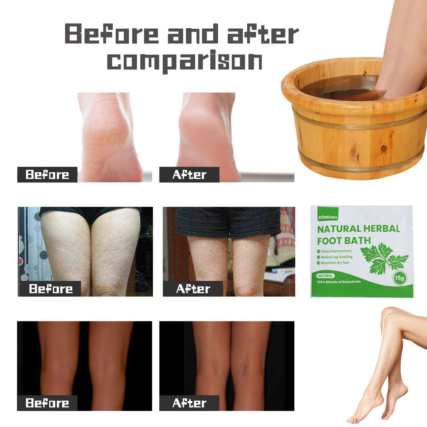 Difethen Natural Mugwort/Wormwood Herbal Foot Soak,Lymphatic Ginger Foot Bath Bag, Anti-Swelling Foot SPA Promote Metabolism, Foot Care 15g/PCS (10PCS)