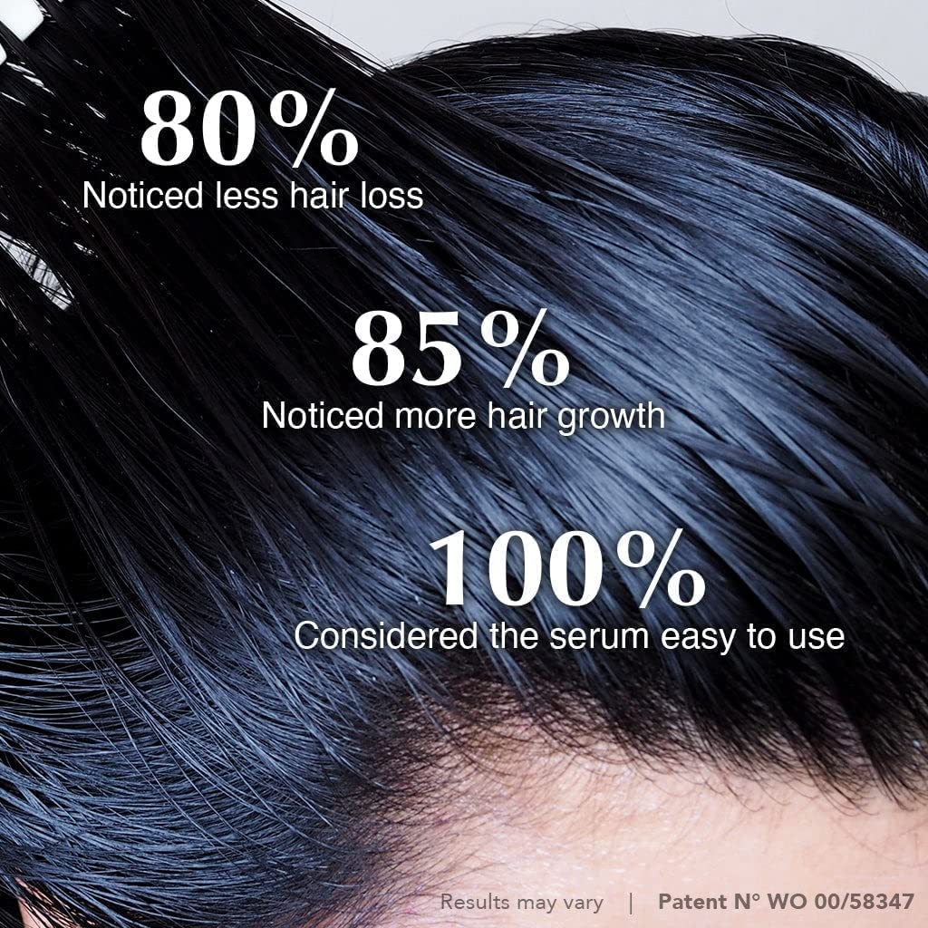 HAIRtamin Scalp Serum Natural Hair Growth Thickening Treatment | Made in USA | Helps Increase Hair Thickness and Aids Against Hair Thinning and Hair Fall Out | Moisturizes and Soothes Dry Itchy Scalp