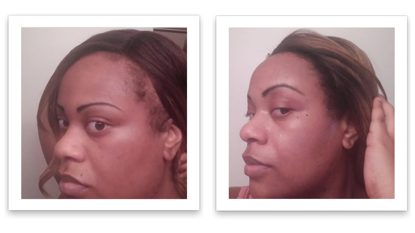 Caboki 10X Hair Powder for Thinning Hair. Instantly Fill In Hairline, Root Touch Up, Cover Bald Spots and Gray Hair. TALC-Free, Healthful Formula. Unisex. Trial Size, Salt and Pepper Dark
