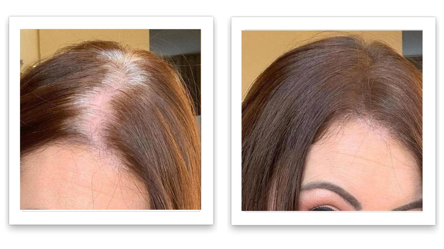 Caboki 10X Hair Powder for Thinning Hair. Instantly Fill In Hairline, Root Touch Up, Cover Bald Spots and Gray Hair. TALC-Free, Healthful Formula. Unisex. Trial Size, Salt and Pepper Dark
