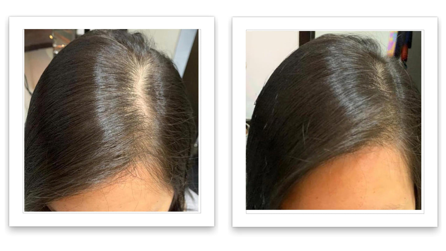 Caboki 10X Hair Powder for Thinning Hair. Instantly Fill In Hairline, Root Touch Up, Cover Bald Spots and Gray Hair. TALC-Free, Healthful Formula. Unisex. Trial Size, Salt and Pepper Dark