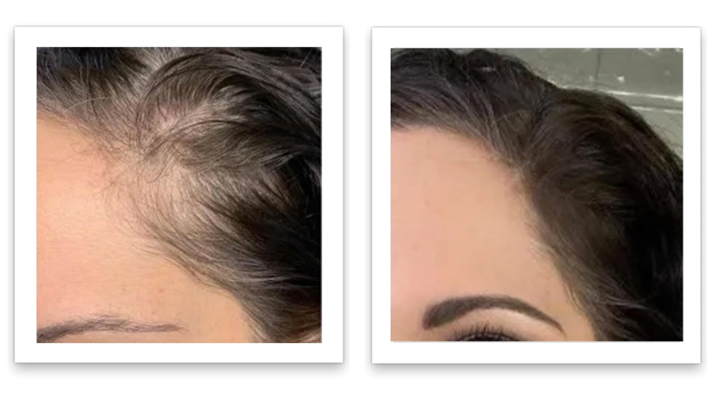 Caboki 10X Hair Powder for Thinning Hair. Instantly Fill In Hairline, Root Touch Up, Cover Bald Spots and Gray Hair. TALC-Free, Healthful Formula. Unisex. Trial Size, Salt and Pepper Dark