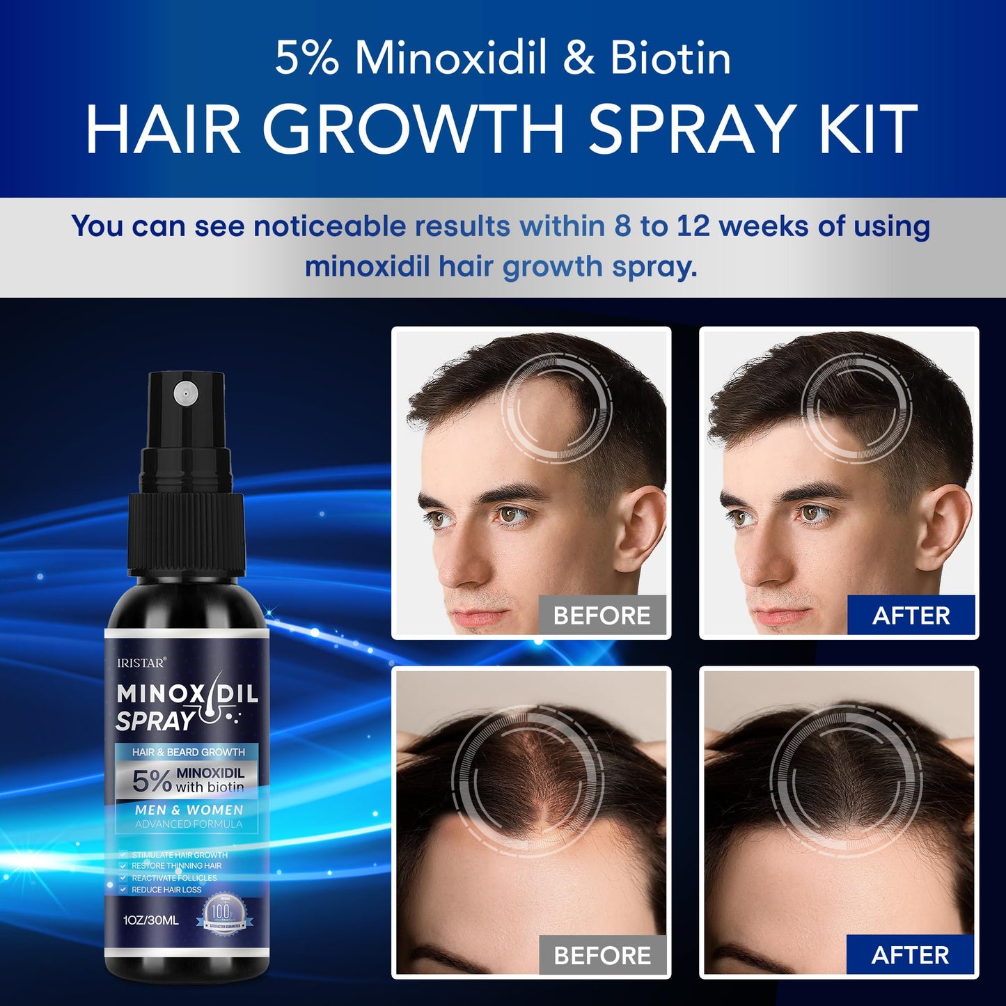 5% Minoxidil for Men Hair, Minoxidil for Women Hair Growth, Minoxidil for Men Beard, Minoxidil Spray, Minoxidil 5 Percent, Minoxidil 5% Hair Regrowth for Men 30ml x 2 Bottles
