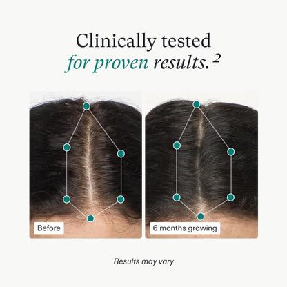 Nutrafol Women's Hair Growth