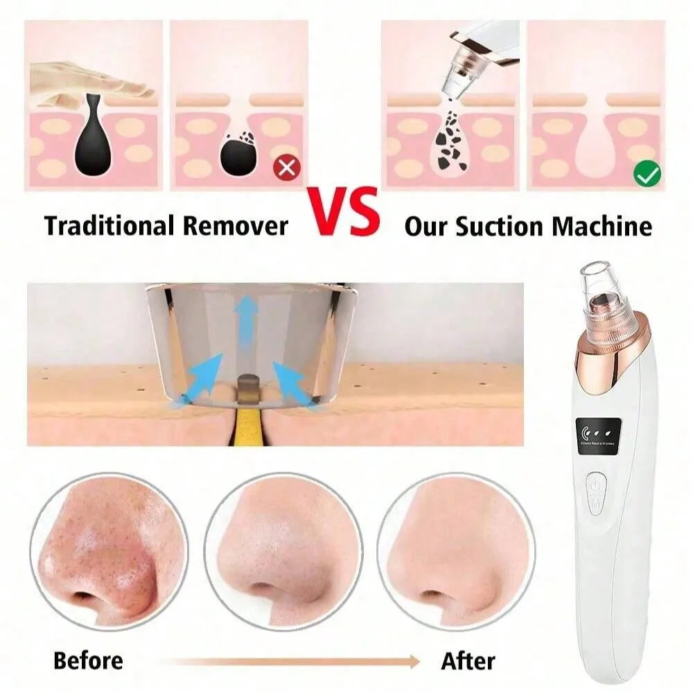 Electric Blackhead Pore Vacuum