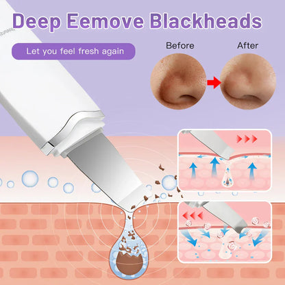 Ultrasonic Facial Skin Scrubber Tool