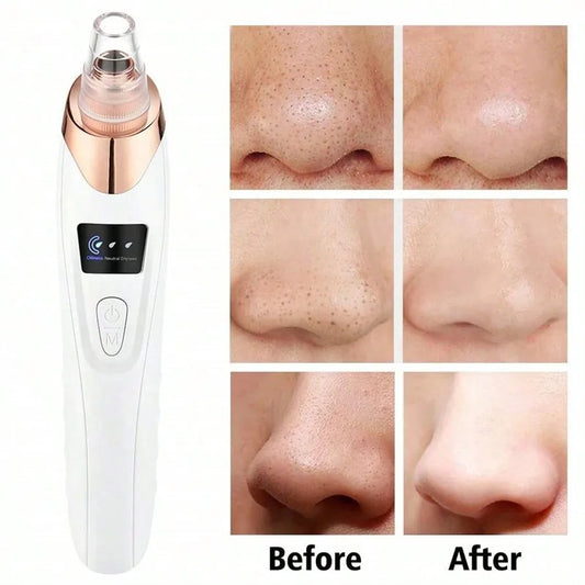 Electric Blackhead Remover Vacuum Cleanser