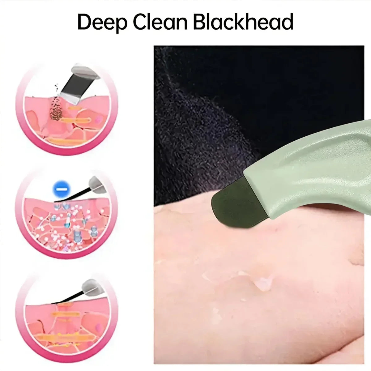 Facial Blackhead Removal Skin Tool