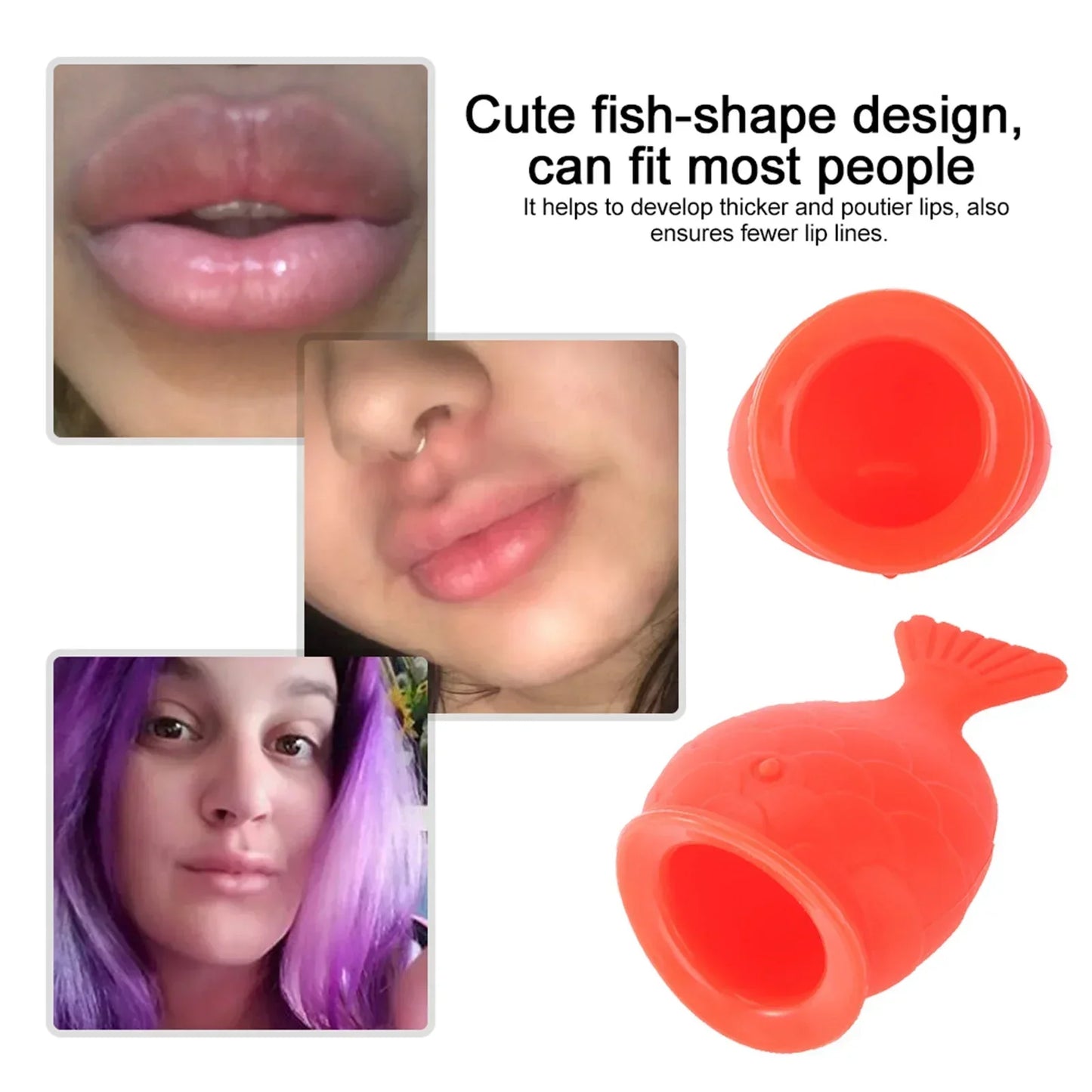 Fish Mouth Silicone Lip Filler