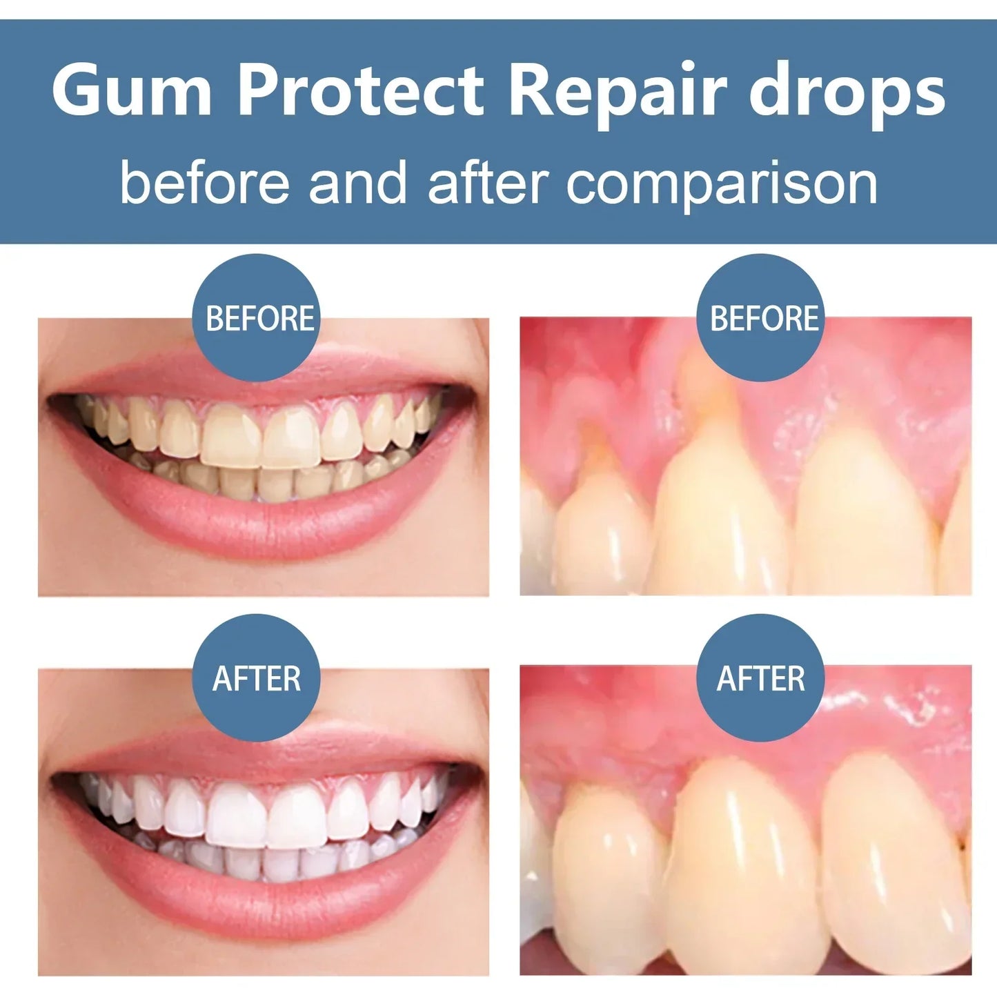 Rapid Repair Gum Serum Drops