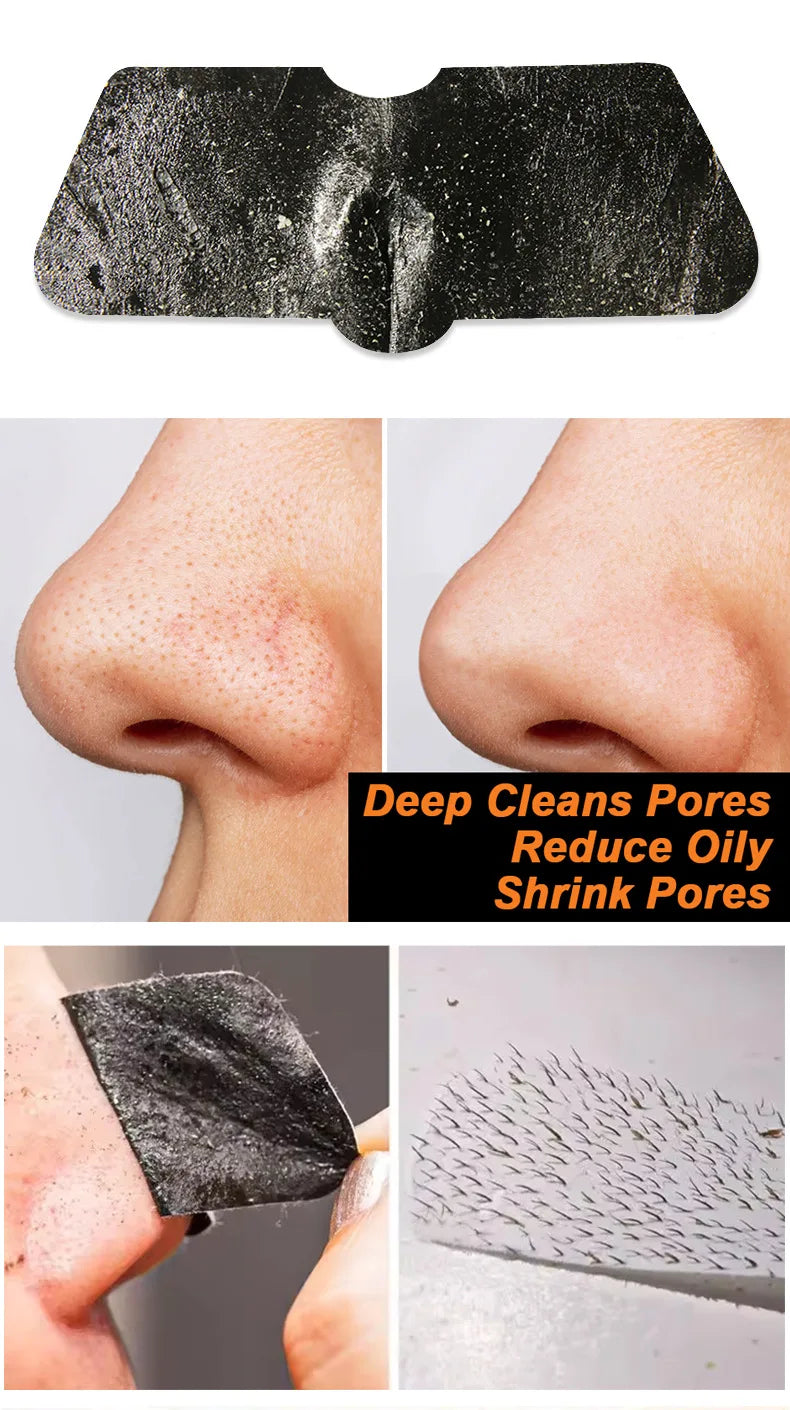 Nose Blackhead Remover Strips